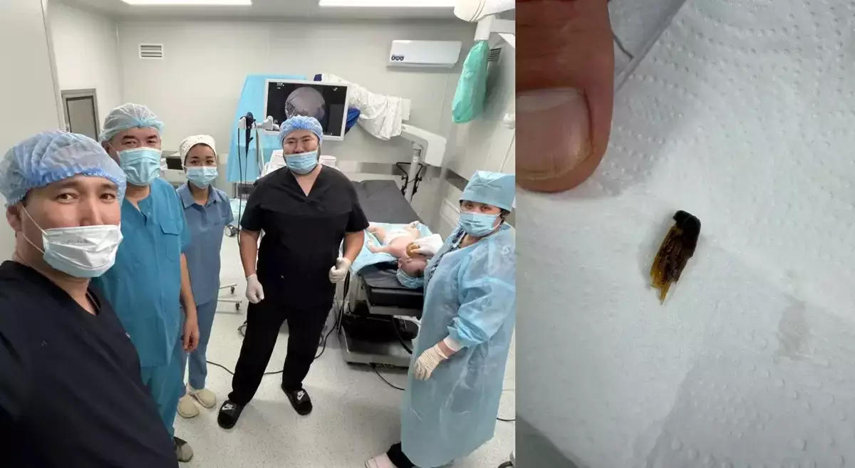 Годовалого ребенка спасли врачи в Актау