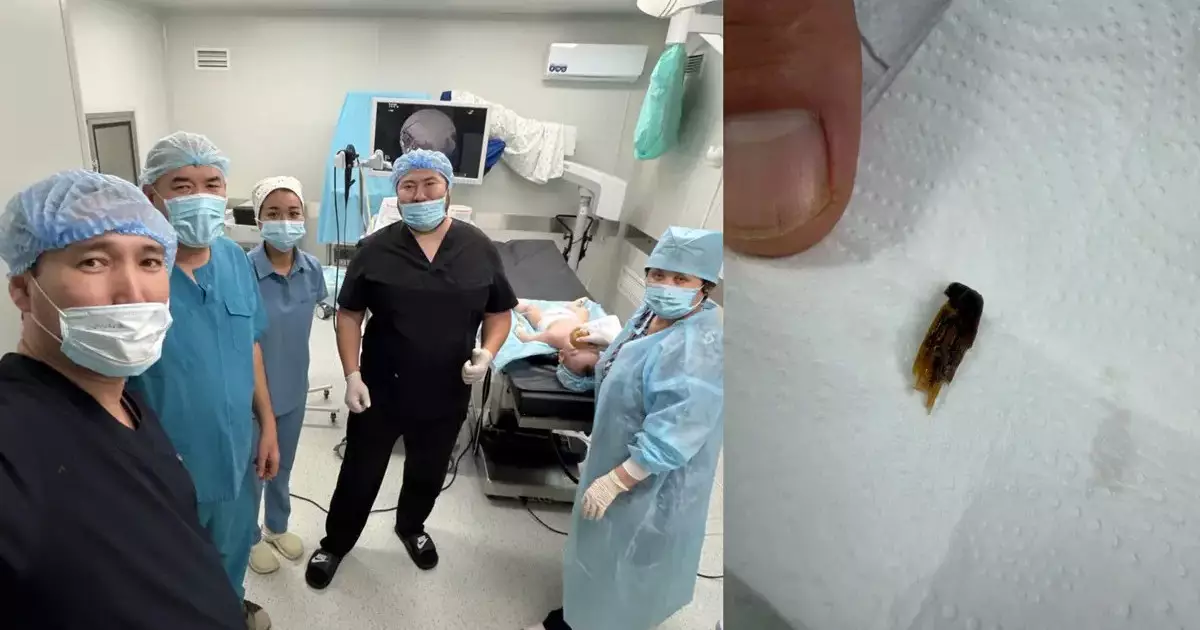  Ақтаулық дәрігерлер тыныс жолына бөгде зат тұрып қалған баланы құтқарды 