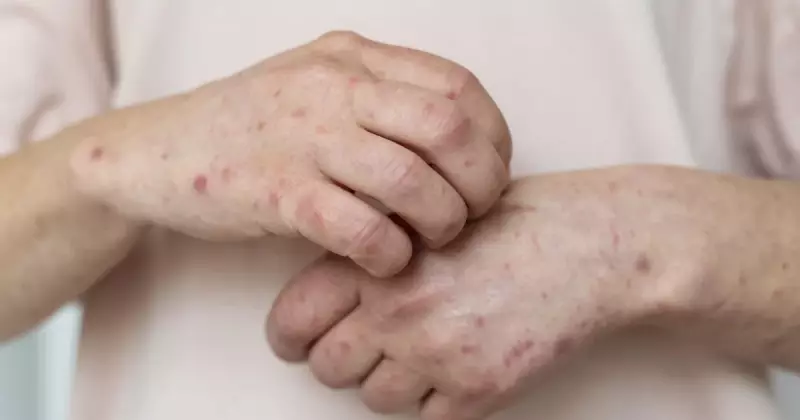 Почему в Казахстане много заболевших корью?