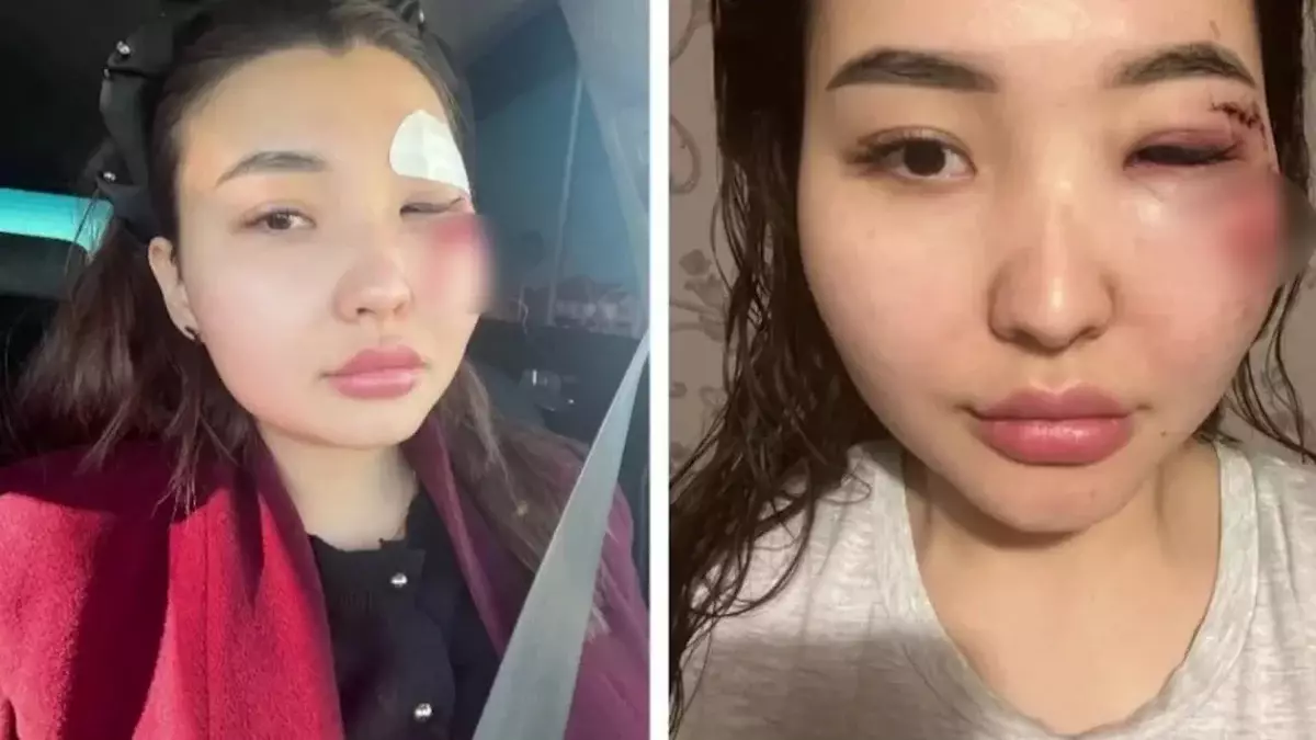 Соққыға жығылған атыраулық блогердің ісіне қатысты нүкте қойылды