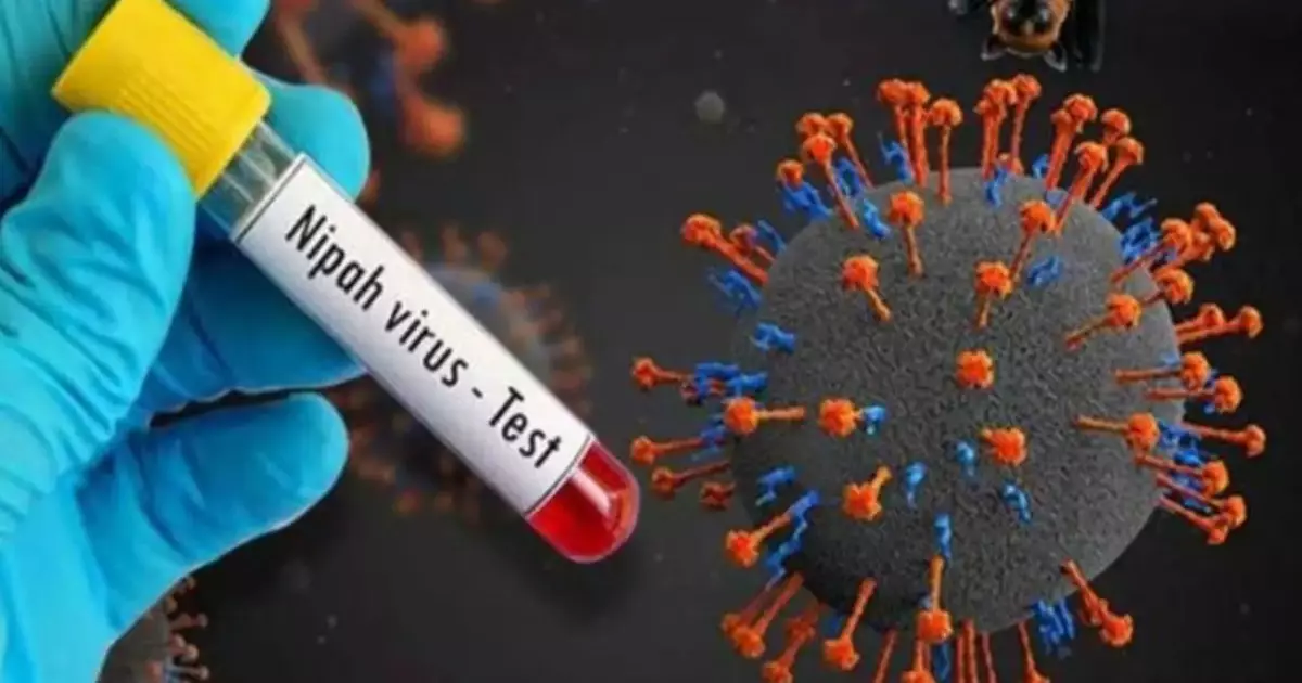  Нипах вирусы қаншалық қауіпті, адамға қалай жұғады? Соңғы ахуал қандай? 