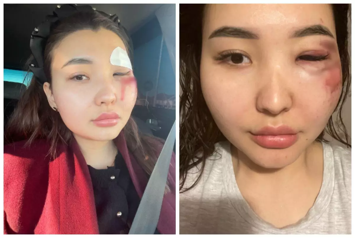 Атырауда блогерді соққыға жыққандарға сот үкімі шыққанымен, түрмеге бірден бармайды