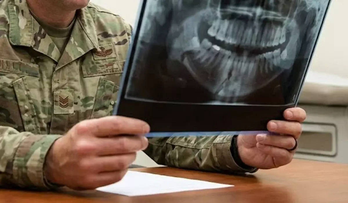 Жамбыл облысында әскери бөлімдегі жанжал: сарбаздың жақ сүйегі сынған