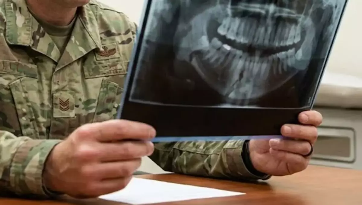 Жамбыл облысындағы әскери бөлімде сарбаздың жақ сүйегі сынған