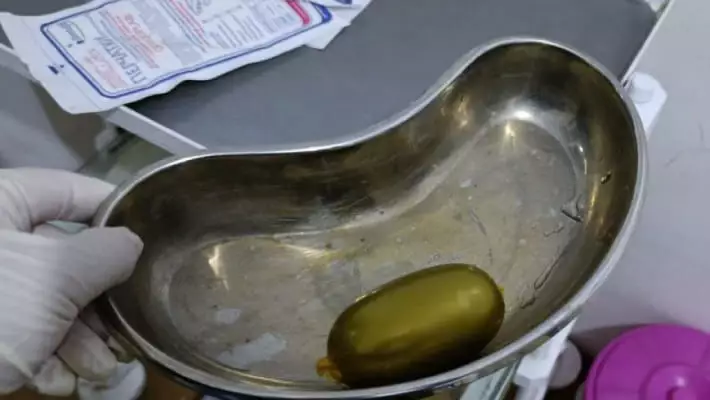 Супруги пытались ввезти в Узбекистан почти 800 граммов опия внутри себя