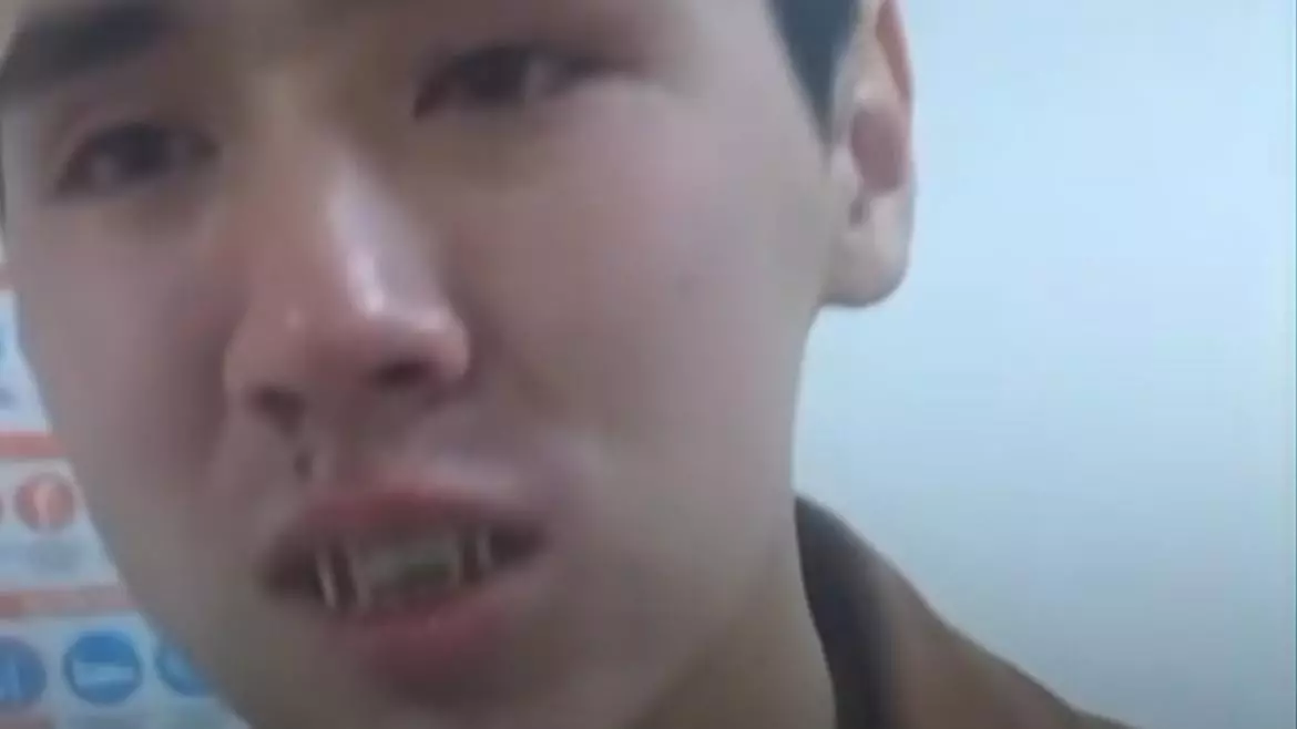 Әскердегі соққы: Жақ сүйегі сынған сарбазды туыстарынан жасырған