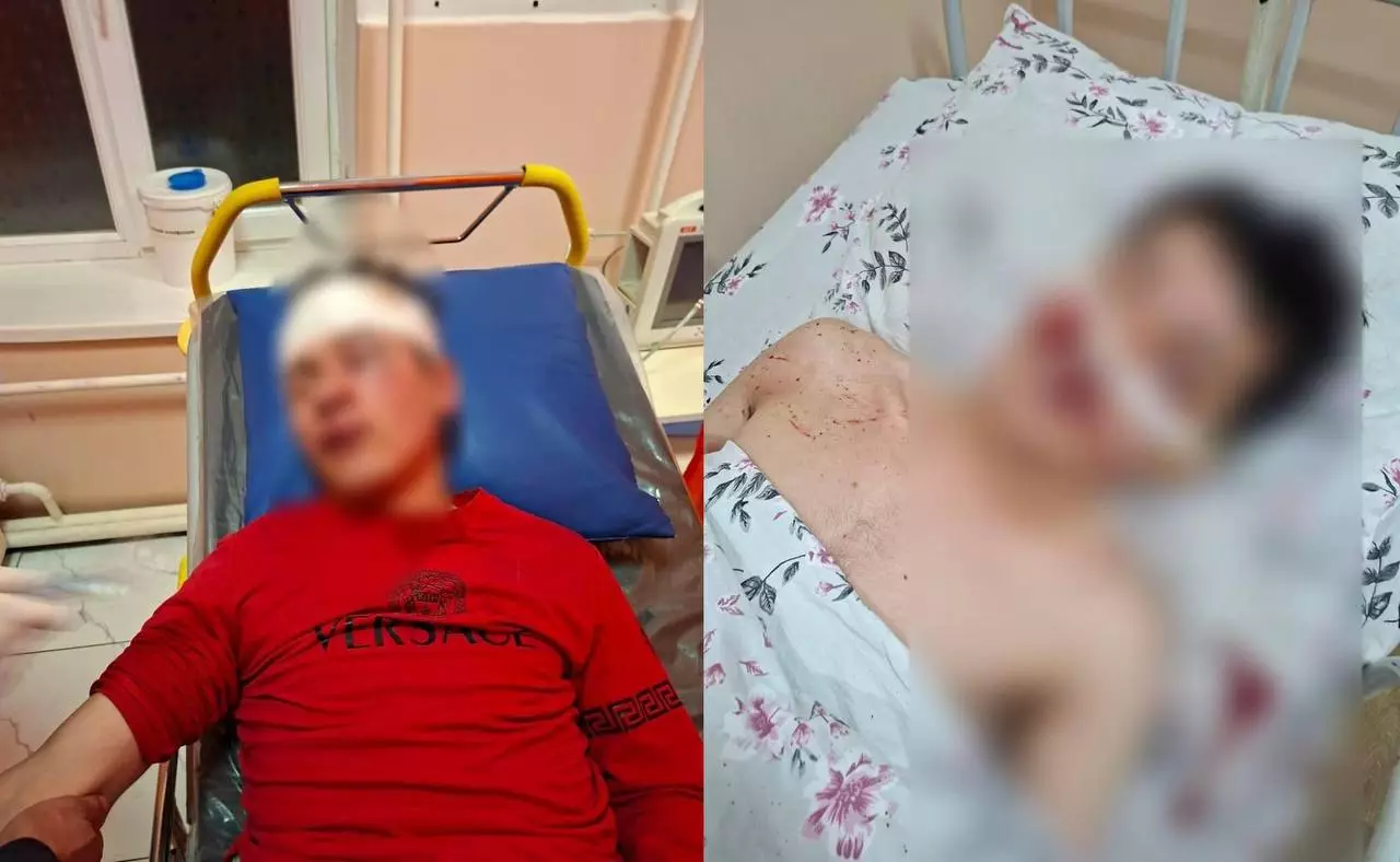 Көкпардағы төбелес: «Баламды 25 адам ұрды, ешкім қамалмады» дейді анасы