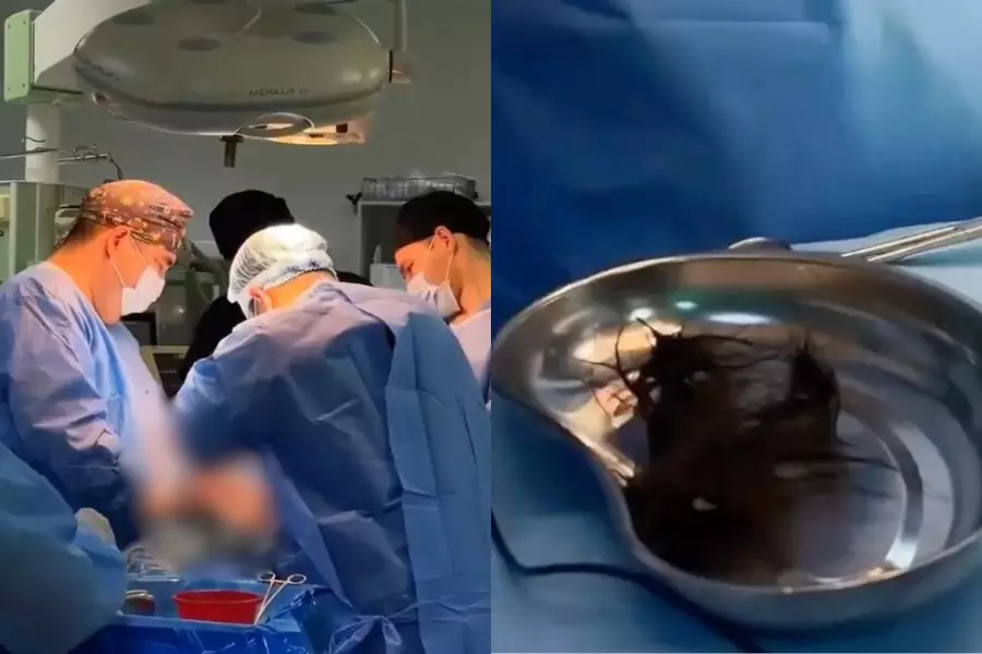 Түркістанда 15 жастағы қыздың ішінен 1 келідей шаш алынды