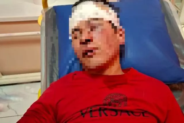 «Денесін малша мыжғылаған»: Түркістан облысында сұмдық жағдай орын алды