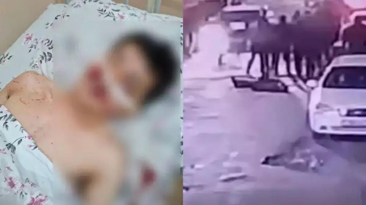 Көкпардан кейінгі жанжал: Сайрамда 20 жасар жігіт аяусыз соққыға жығылды (ВИДЕО)