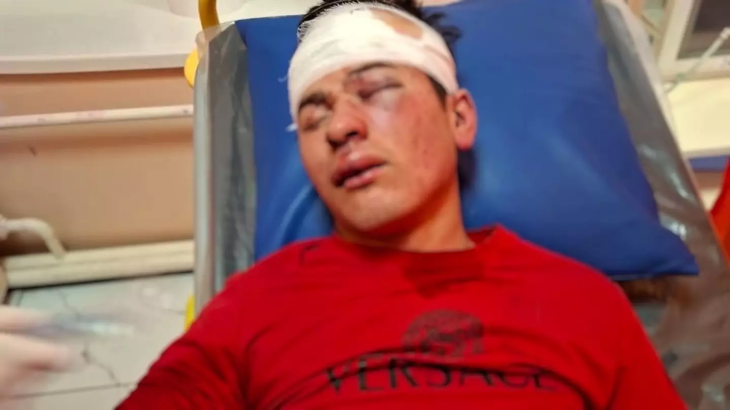 “Басынан теуіп, талып қалғанша жәбір көрсеткен”: Түркістан облысында 20 жастағы жігіт комаға түсті