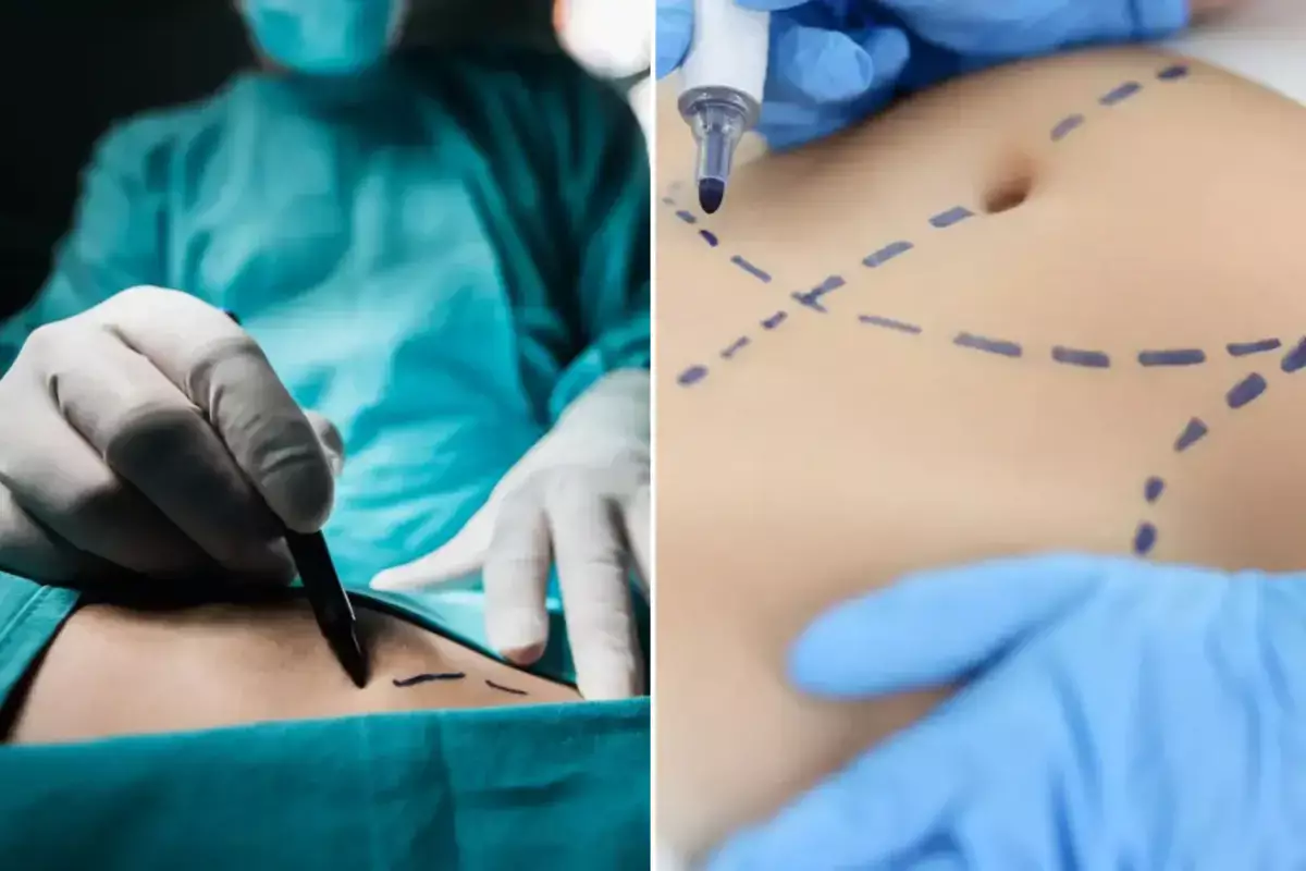 Названы главные тренды пластической хирургии в 2026 году - новости на Lada.kz 18.02.2026