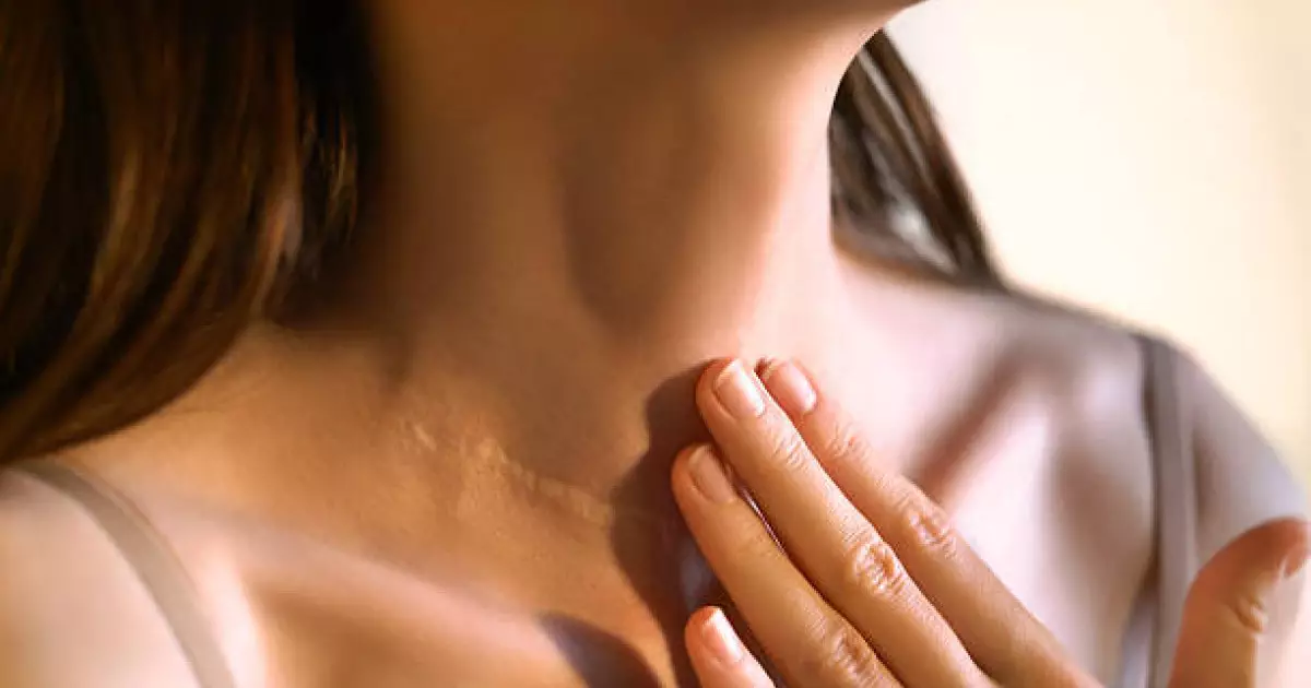  Йод жетіспегенде байқалатын белгілер 