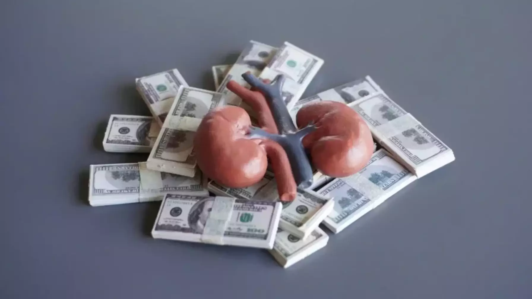 Бүйрегін 13 миллион теңгеге келіскен сатпақ болған 