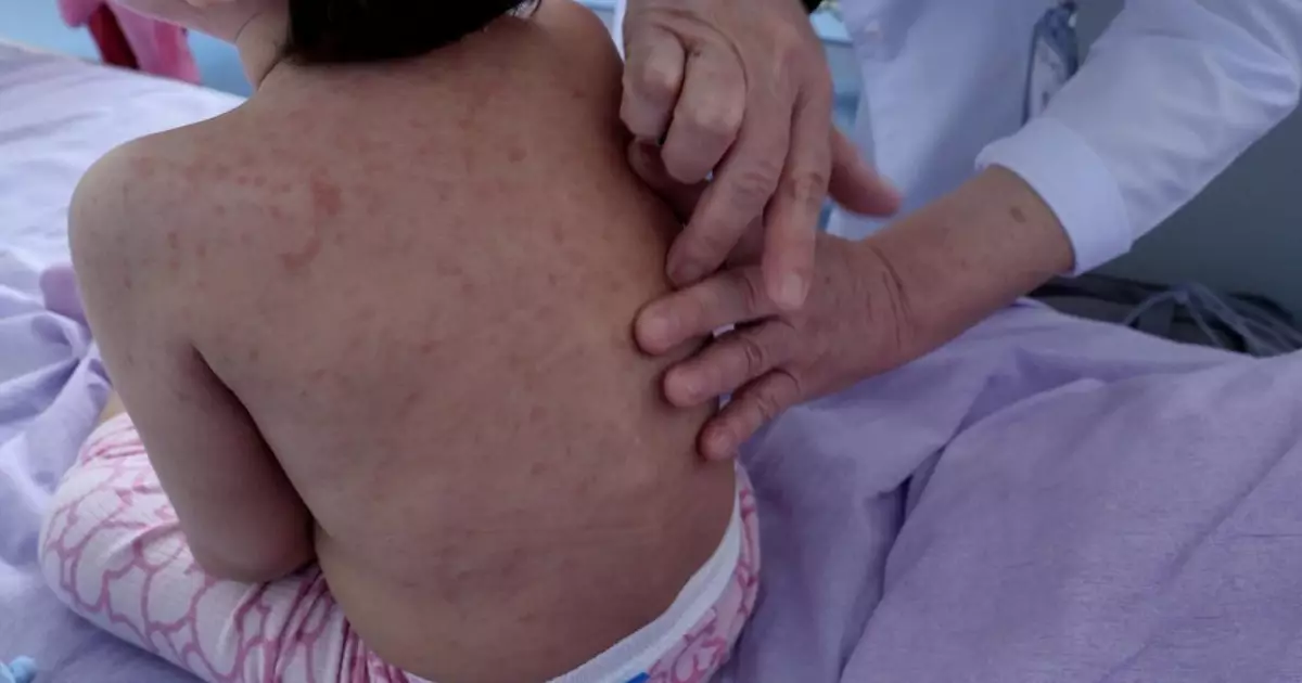   Дәрігерлер ата-аналарға үндеу жасады   