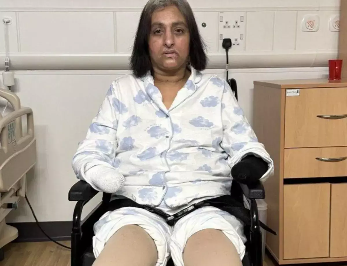 Женщине ампутировали конечности из-за слюны собаки - новости на Lada.kz 21.02.2026