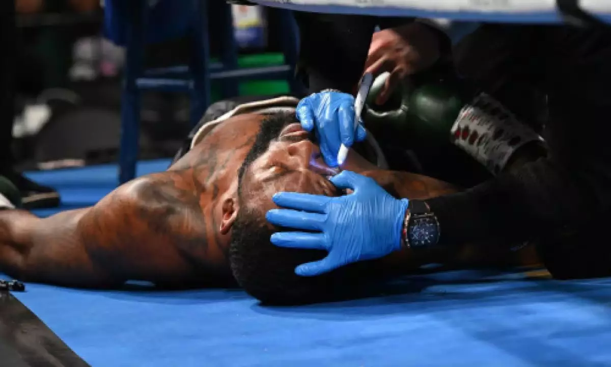АҚШ боксшысы раунд арасындағы үзілісте есінен танып қалды