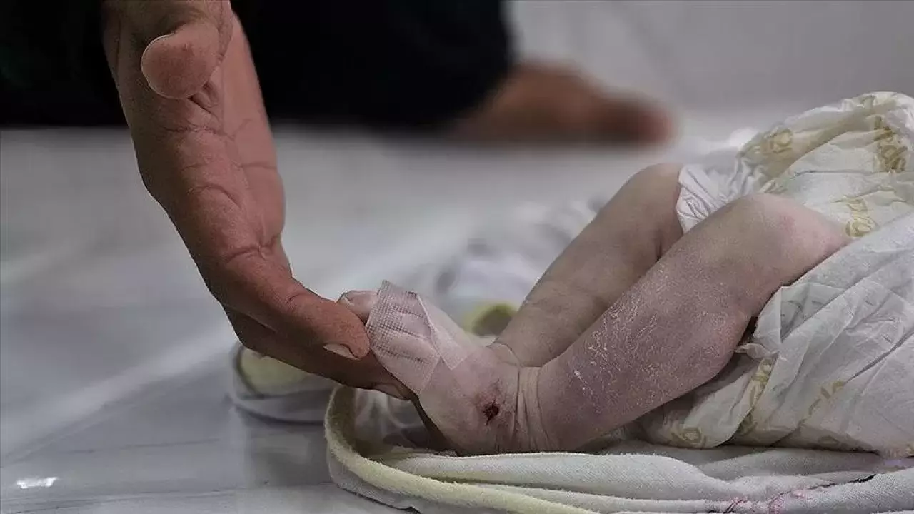 "Қайтыс болған адамның жатырында жетілген". Ұлыбританияда ерекше "туған" сәби жайлы тың дерек шықты