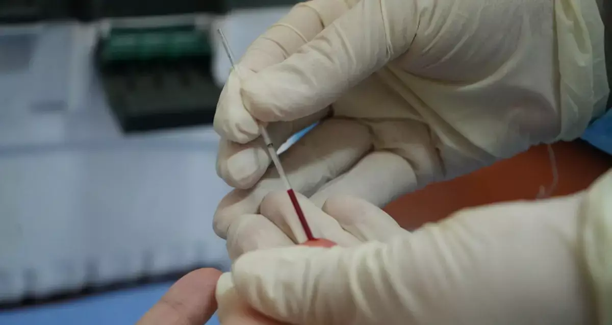 В Мангистау зафиксирован спад инфицирования ВИЧ - новости на Lada.kz 24.02.2026