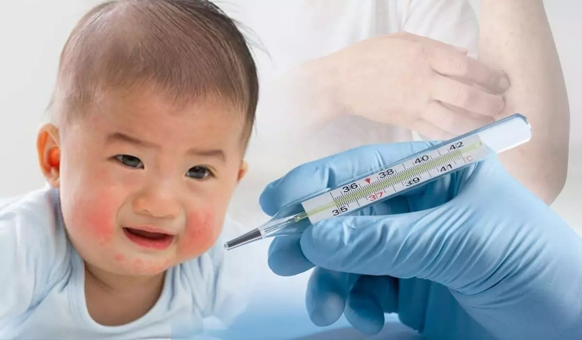 Қызылша індеті: балалар арасында қайталанып өрши бастады