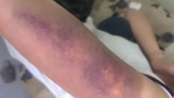 Қарағандыда бір топ жасөспірім қыз баланы соққыға жықты