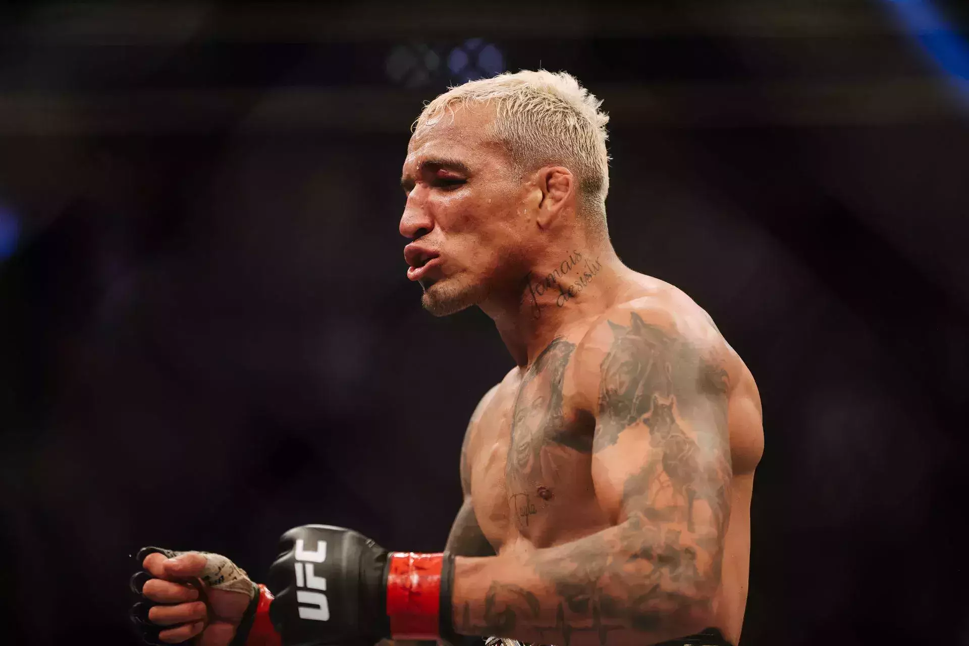 «Я мог остаться парализованным»: Чарльз Оливейра раскрыл детали ужасной травмы