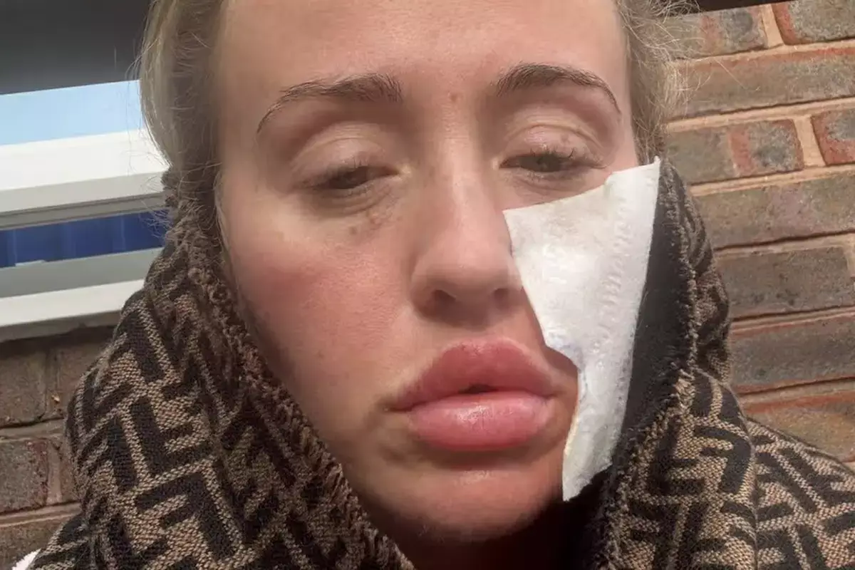 Из-за редкой болезни женщина не может выходить из дома, когда на улице ветер или холодно - новости на Lada.kz 26.02.2026