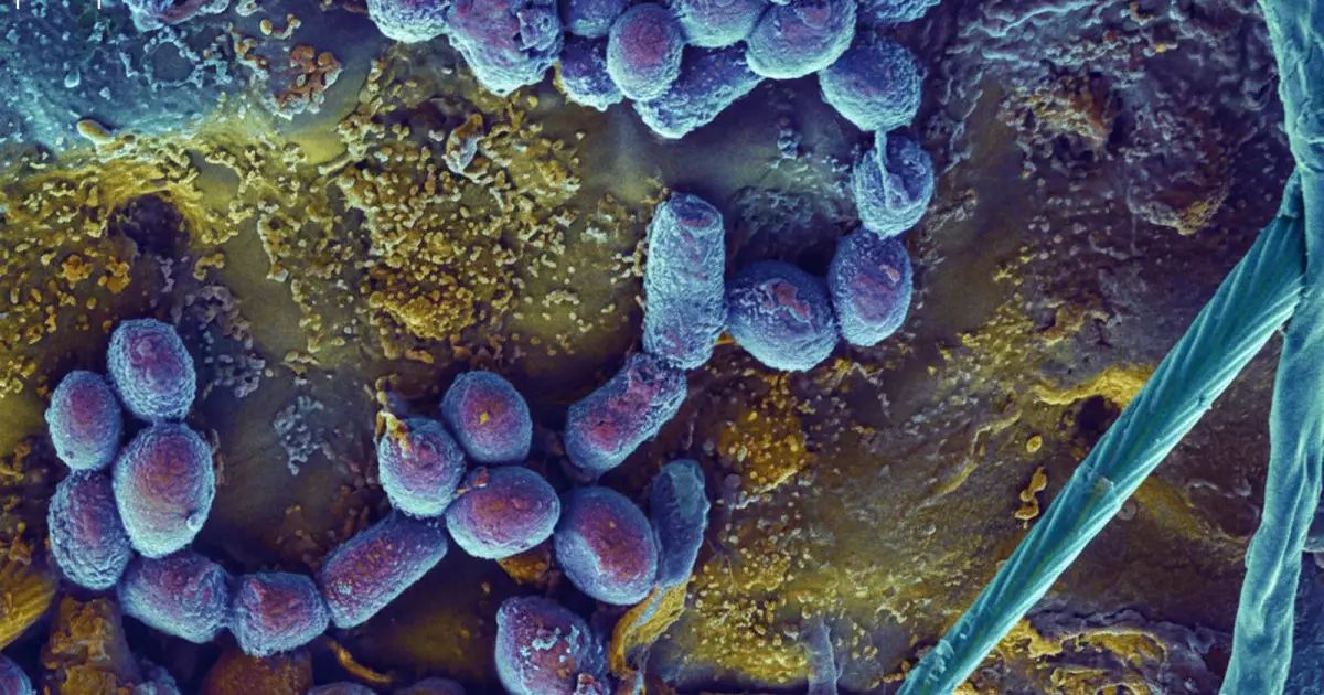  Ғалымдар қатерлі ісікті ішінен жеп жоятын бактерияларды сынақтан өткізіп жатыр 