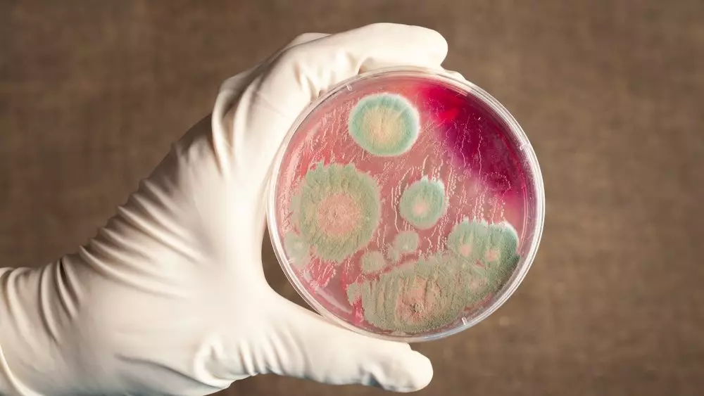 Шымкентте аса қауіпті инфекция туралы дерек тіркелді