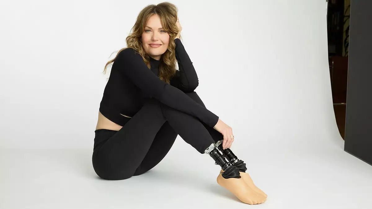 Финалистка "Танцев со звездами" и паралимпийка Эми Пёрди в 19 лет "боролась за свою жизнь" с шансом на выживание в 2%.