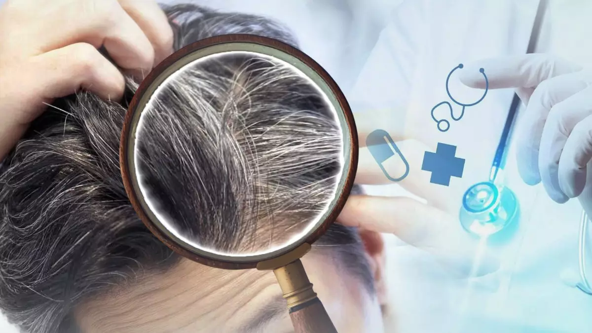 Жастардың шашы неге ерте ағарады? Маман түсіндірді