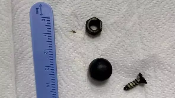 Врачи извлекли магнит и металлические предметы из кишечника ребенка в Шымкенте