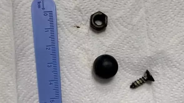 Шымкентте дәрігерлер баланың ішегінен магнит пен металл заттарды алып шықты