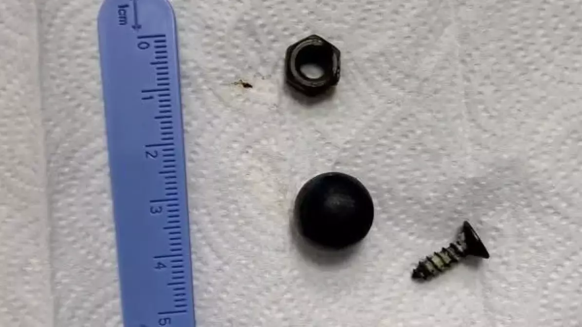 Шымкентте дәрігерлер баланың ішегінен магнит пен металл заттар алып шықты