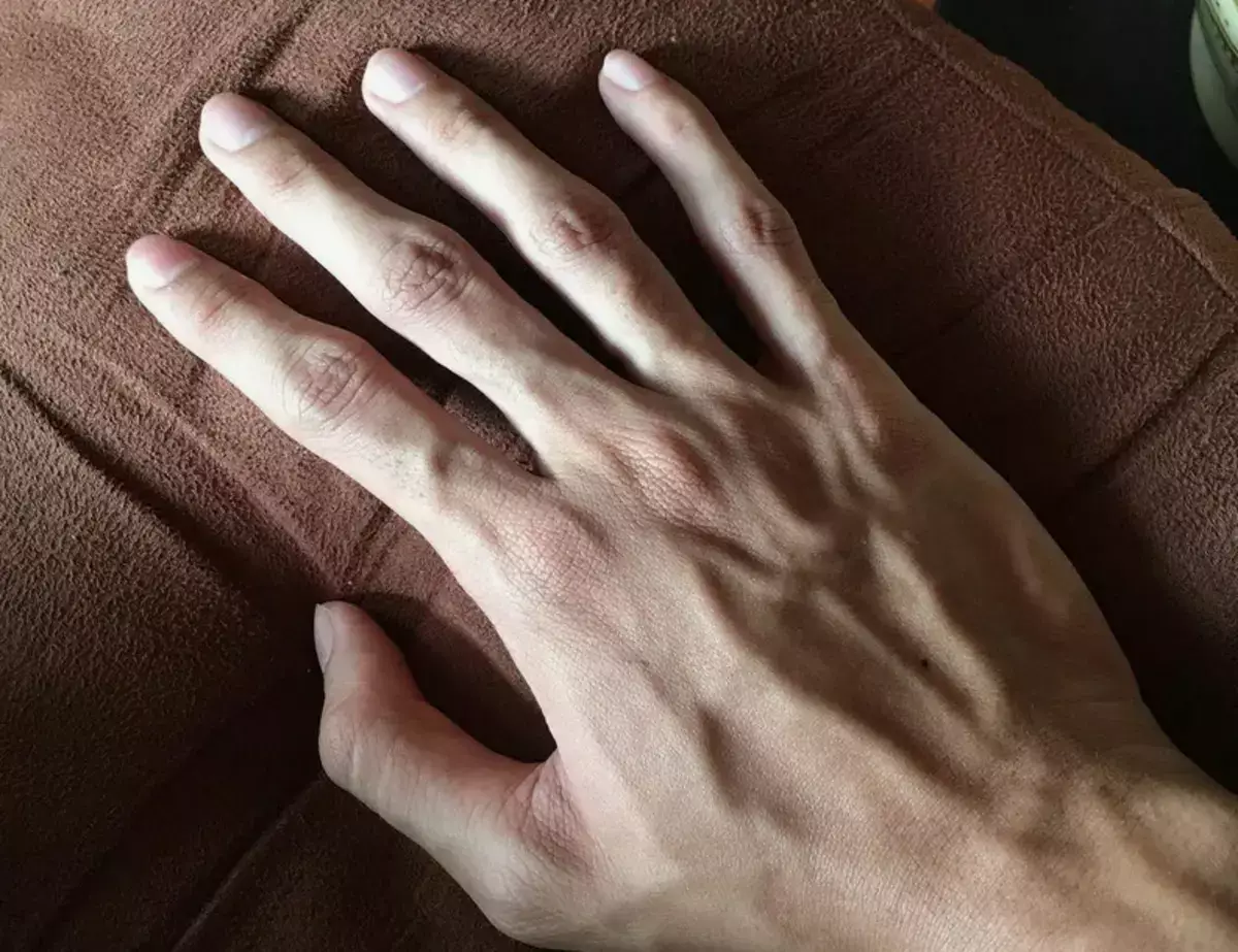 Фотография руки может помочь выявить опасное заболевание - новости на Lada.kz 11.03.2026