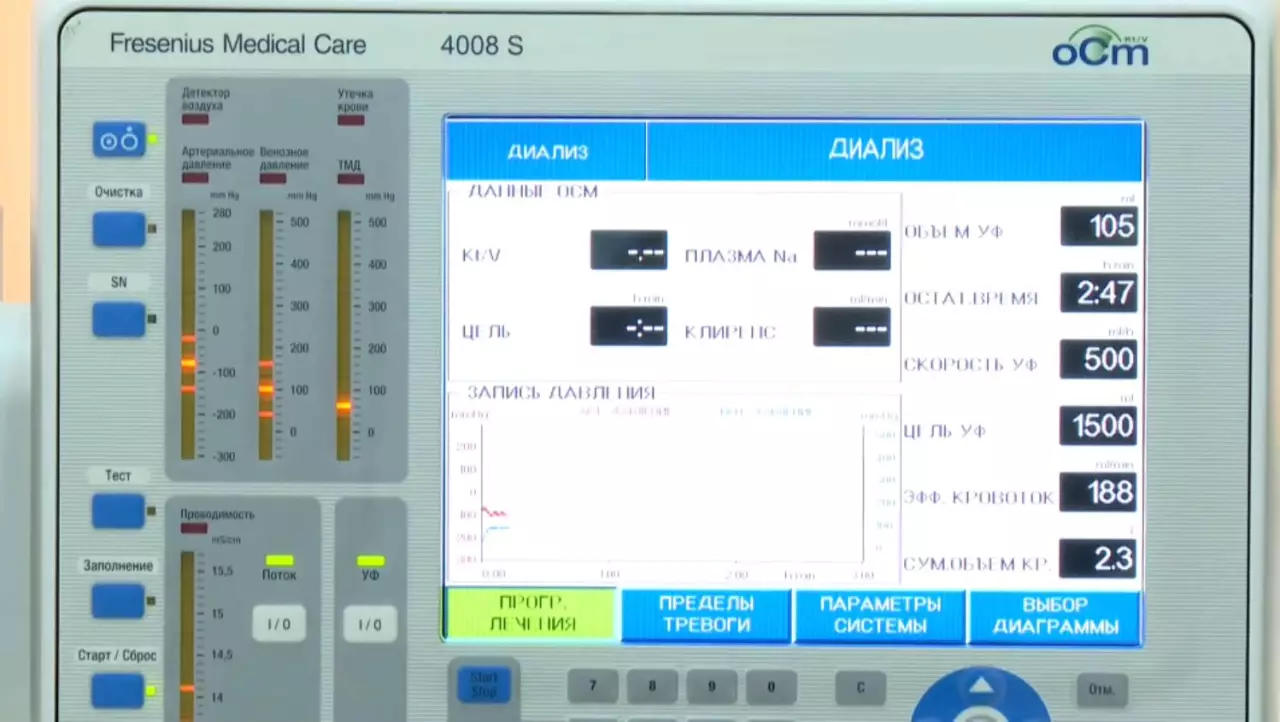 Қазақстанда 4 мыңға жуық адам бүйрек ауыстыруға мұқтаж