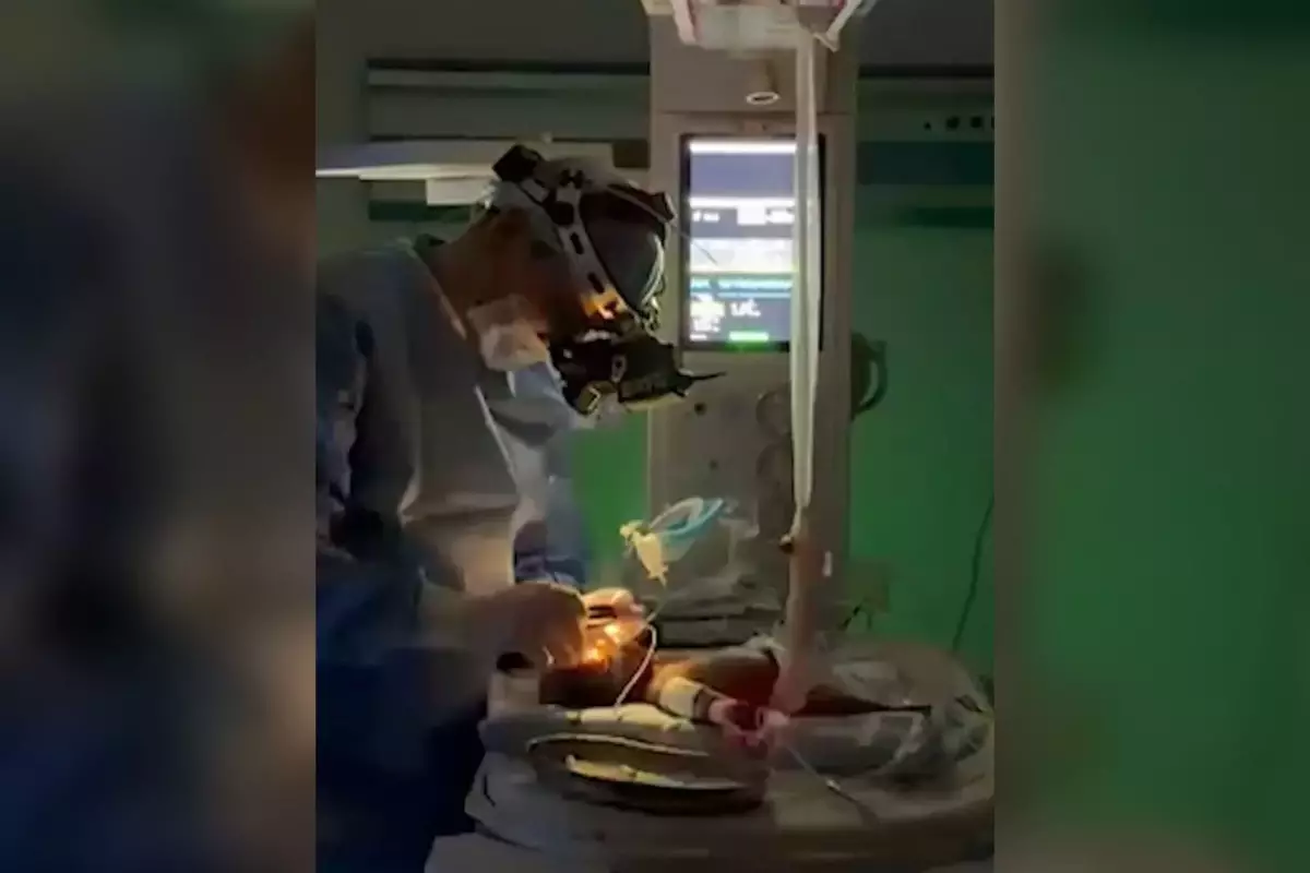 Шымкентте салмағы 650 грамм шала туған шақалақтың көзіне ота жасалды