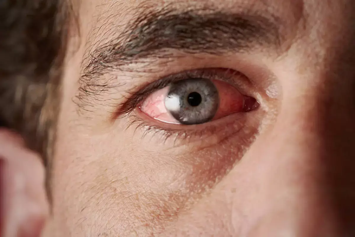 Препарат для похудения может лишить зрения: ученые предупреждают о глазном инсульте - новости на Lada.kz 13.03.2026