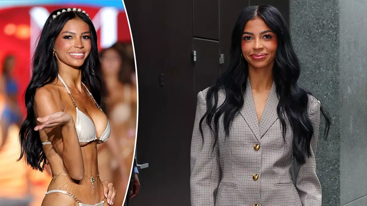 Звезда "Жен мормонов" весит всего 45 кг при росте 178 см и признается в зависимости от GLP-1.