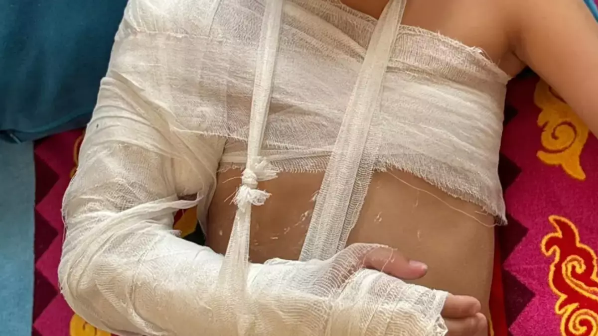 Ақтауда ойын алаңындағы темір қоршау құлап, 8 жасар бала жарақат алды