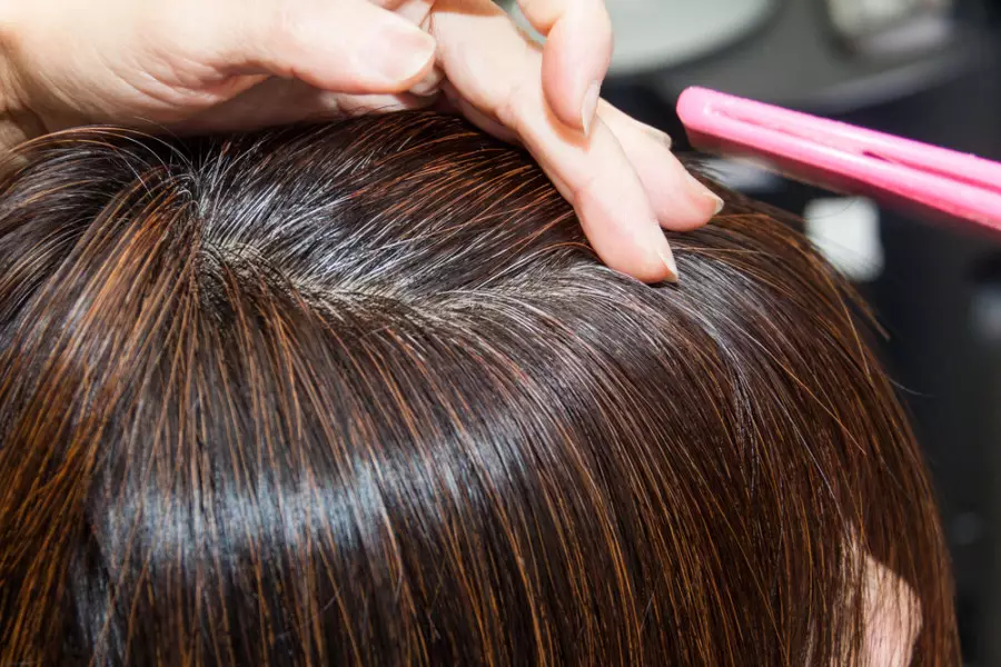 Ақ шашты жұлудың салдары қандай? Дәрігер ескерту жасады