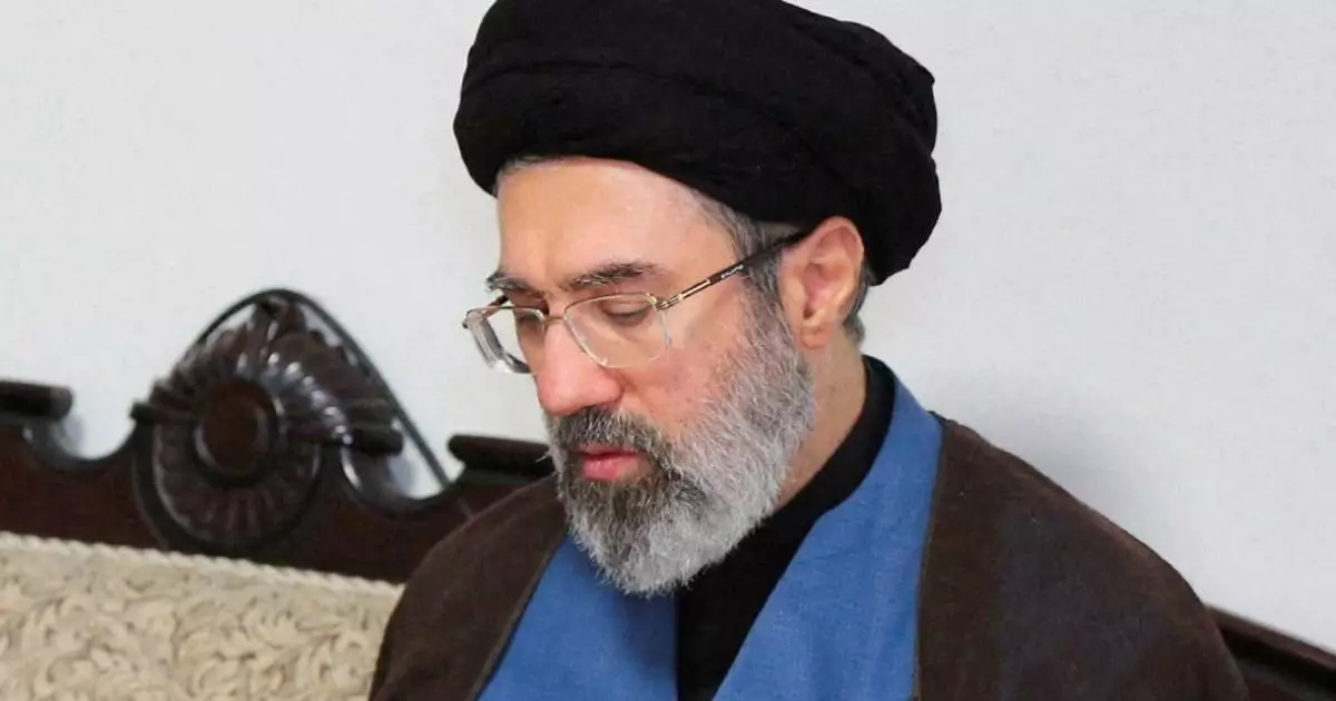  Хаменей аяғынан айрылған және комада жатыр – шетелдік БАҚ 