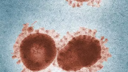 Лондонда менингит өршіді: екі адам қайтыс болды