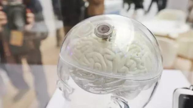 Сал ауруына шалдыққан адамдар енді чиптің көмегімен қозғала алады