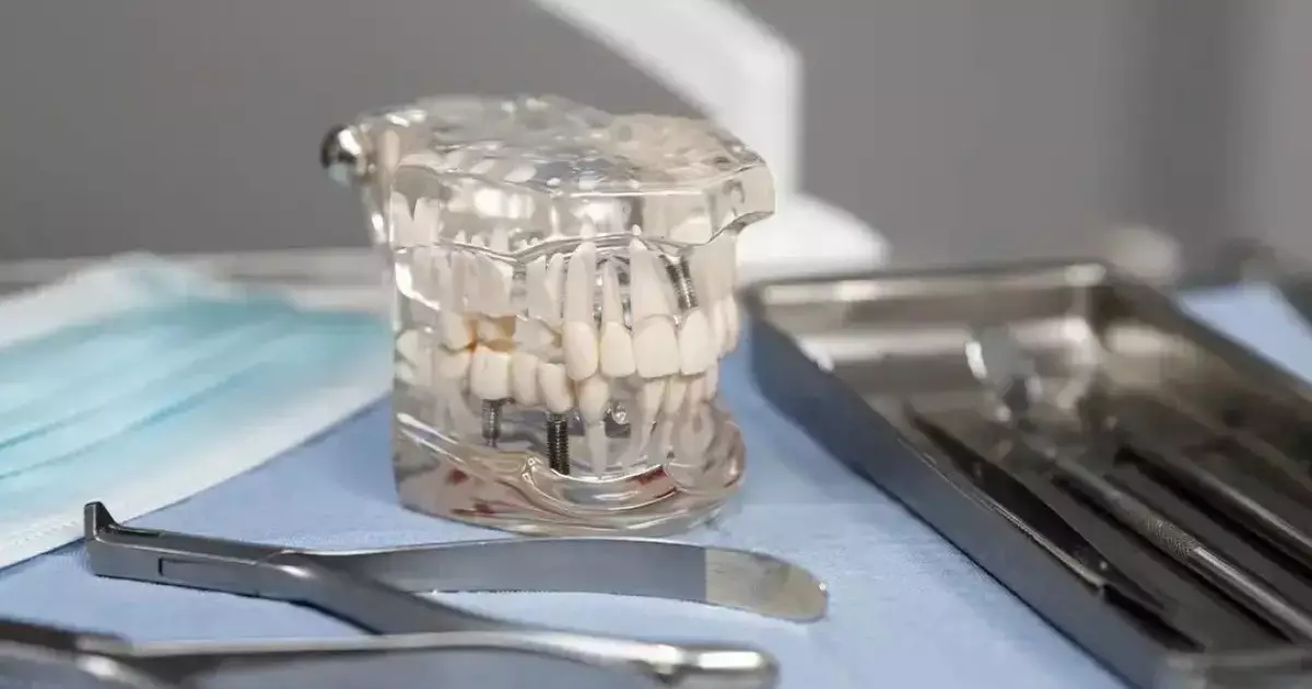  Қазақстанда 170-тен астам стоматологиялық клиника жабылды 