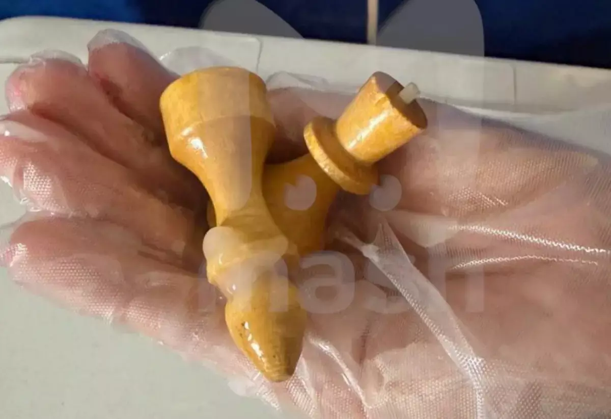 У шахматиста из заднего прохода извлекли слона и ферзя - новости на Lada.kz 20.03.2026