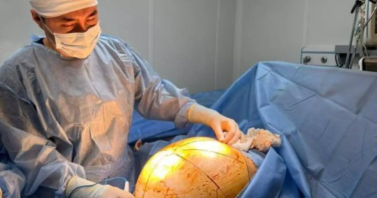   Дәрігерлер науқастың ішіндегі 25 келілік ісікті алып тастады   