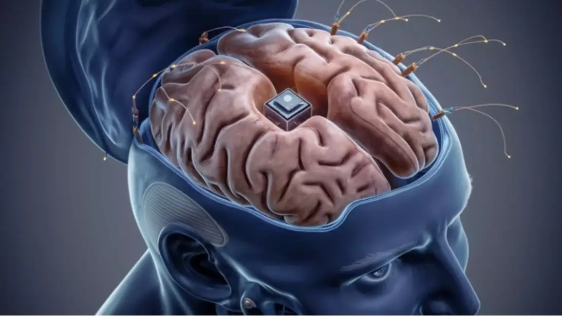Neuralink импланты: сөйлеу қабілетін қайтарудағы жаңа кезең
