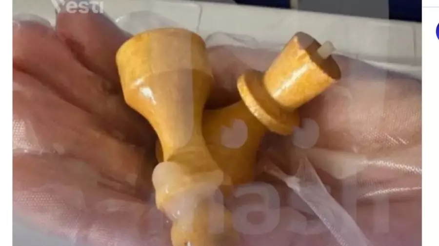 Дәрігер еркектің тік ішегінен шахмат фигураларын шығарып алды