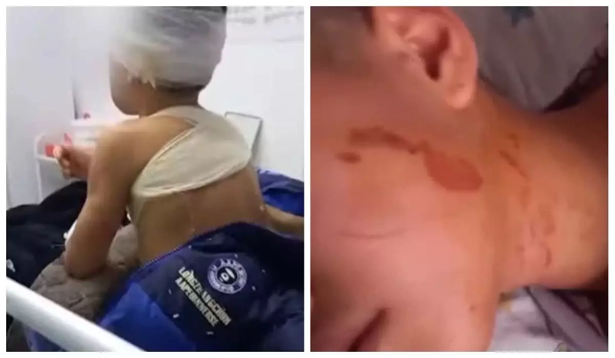 Шымкентте балаларын үтікпен күйдіріп, ауыздарына қыздырылған шанышқы басқан әйелге қатысты сот үкімі шықты